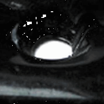 VOORRUITLIJST AFDEKPLAAT VOORRUITLIJST AFDEKPLAAT